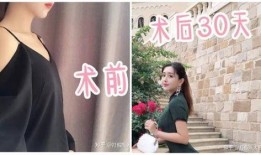 丰胸医生爆料是真的吗视频,丰胸医生爆料视频的真实性探讨